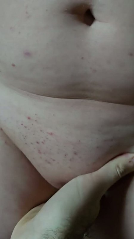 bed bondage hospital nurse ward